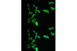 Immunofluorescence analysis of A549 cells using AK1 antibody. (Adenylate Kinase 1 Antikörper)