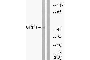 Western blot analysis of extracts from RAW264. (CPN1 Antikörper)