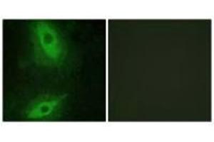 Immunofluorescence analysis of HeLa cells, using TNFSF15 antibody. (TNFSF15 Antikörper  (C-Term))