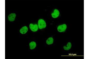 Immunofluorescence of monoclonal antibody to FKBP5 on HeLa cell. (FKBP5 Antikörper  (AA 1-457))