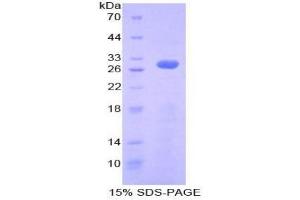 SDS-PAGE analysis of Human Ribonuclease Inhibitor Protein. (RNH1 Protein)