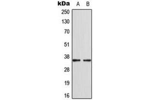 Western blot analysis of CDKL4 expression in MCF7 (A), HepG2 (B) whole cell lysates. (CDKL4 Antikörper  (C-Term))