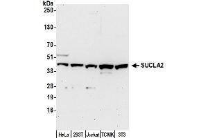 anti-Succinate-CoA Ligase, ADP-Forming, beta Subunit (SUCLA2) (AA 413-463) antibody