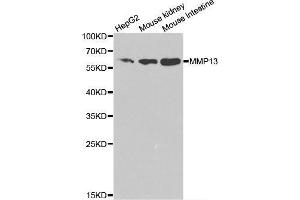 Western blot analysis of extracts of various cell lines, using MMP13 antibody.