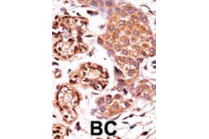 Immunohistochemistry (IHC) image for anti-C-Abl Oncogene 1, Non-Receptor tyrosine Kinase (ABL1) (pTyr412) antibody (ABIN3001744) (ABL1 Antikörper  (pTyr412))