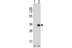 Western blot analysis of CNOT8 (arrow) using rabbit polyclonal CNOT8 Antibody (N-term) .