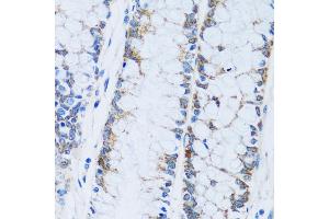 Immunohistochemistry of paraffin-embedded human colon using C antibody (ABIN7266074) at dilution of 1:100 (40x lens). (CA13 Antikörper  (AA 1-220))