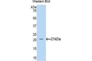 Detection of Recombinant NRP1, Human using Polyclonal Antibody to Neuropilin 1 (NRP1) (Neuropilin 1 Antikörper  (AA 646-814))