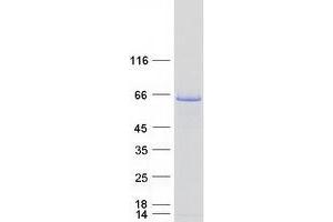 Validation with Western Blot