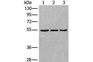 Western Blotting (WB) image for anti-WD Repeat, Sterile alpha Motif and U-Box Domain Containing 1 (WDSUB1) antibody (ABIN7254652)
