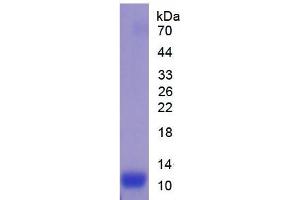 SDS-PAGE analysis of Mouse IL13Ra2 Protein. (IL13RA2 Protein)