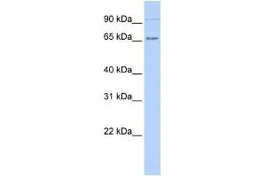 Human 721_B; WB Suggested Anti-IKZF4 Antibody Titration: 0. (IKZF4 Antikörper  (N-Term))