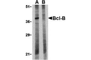 Western Blotting (WB) image for anti-BCL2-Like 10 (Apoptosis Facilitator) (BCL2L10) (N-Term) antibody (ABIN1031267)