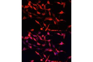 Immunofluorescence analysis of PC-12 cells using ENO3 antibody (ABIN7266960) at dilution of 1:100. (ENO3 Antikörper  (AA 1-190))