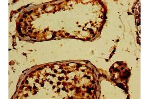 Immunohistochemistry of paraffin-embedded human testis tissue using ABIN7163836 at dilution of 1:100