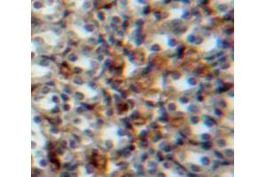 IHC-P analysis of Kidney tissue, with DAB staining. (Vitamin D-Binding Protein Antikörper  (AA 17-476))