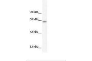 Image no. 1 for anti-Metal-Regulatory Transcription Factor 1 (MTF1) (AA 562-611) antibody (ABIN202901) (MTF1 Antikörper  (AA 562-611))