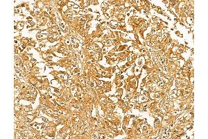 anti-Leber Congenital Amaurosis 5 (LCA5) (C-Term) antibody