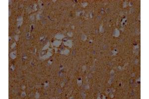 IHC image of ABIN7152226 diluted at 1:200 and staining in paraffin-embedded human brain tissue performed on a Leica BondTM system. (SLC1A3 Antikörper  (AA 146-236))