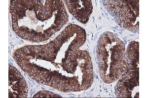 Immunohistochemistry (IHC) image for anti-T-cell surface glycoprotein CD1c (CD1C) antibody (ABIN1497187) (CD1c Antikörper)