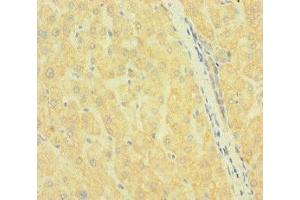 Immunohistochemistry of paraffin-embedded human liver tissue using ABIN7169972 at dilution of 1:100 (SLC38A9 Antikörper  (AA 1-119))