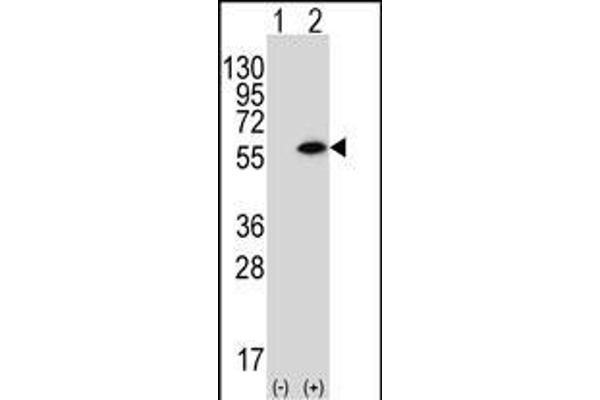 PACSIN1 Antikörper  (N-Term)