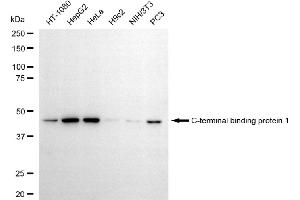 Western blotting analysis using C-terminal binding protein 1 antibody (ABIN7797815).