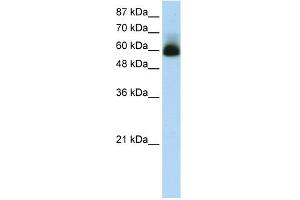 WB Suggested Anti-ZNF307 Antibody Titration:  1. (ZKSCAN4 Antikörper  (N-Term))