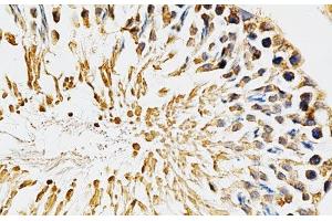 Immunohistochemistry (Paraffin-embedded Sections) (IHC (p)) image for anti-Cytochrome P450, Family 1, Subfamily A, Polypeptide 1 (CYP1A1) antibody (ABIN7010003)