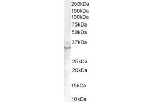 Image no. 1 for anti-Growth Differentiation Factor 15 (GDF15) (C-Term) antibody (ABIN374600) (GDF15 Antikörper  (C-Term))