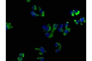 Immunofluorescence staining of HepG2 cells with ABIN7139899 at 1:50, counter-stained with DAPI. (OPRK1 Antikörper  (AA 31-50))