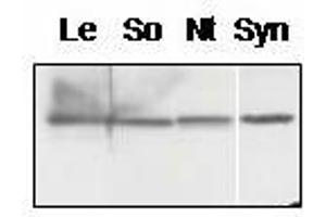 Western blot analysis of chloroplast proteins from tomato (Lycopersicum esculentum, Le, spinach (Spinacia oleracea, So), tobacco (Nicotiana tabacum, Nt) and membrane proteins from Synechocystis sp.