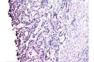 IHC analysis of cortactin using anti-cortactin antibody (ABIN6719306).