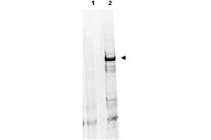 Anti-ATM Monoclonal Antibody - Western Blot Anti ATM Mab with human derived HEK293 cells treated with doxorubicin using  Protein A Purified Mab anti-ATM Protein Kinase pS1981(clone 10H11.