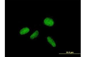 Immunofluorescence of purified MaxPab antibody to ZNF584 on HepG2 cell. (ZNF584 Antikörper  (AA 1-421))