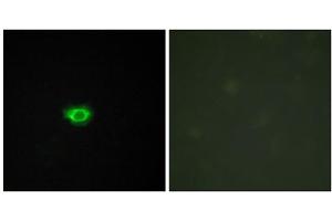 Immunofluorescence analysis of HUVEC cells, using GP108 antibody. (GPR108 Antikörper  (Internal Region))