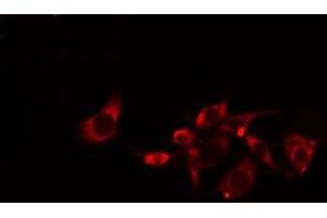 ABIN6275148 staining  Hela cells by IF/ICC. (GJC1 Antikörper  (C-Term))
