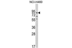 Western blot analysis of MyoGEF Antibody (N-term) in NCI-H460 cell line lysates (35ug/lane). (PLEKHG6 Antikörper  (N-Term))