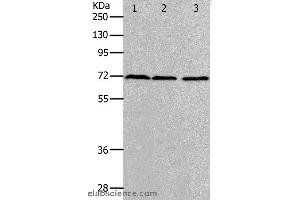 Western blot analysis of K562, hela and 293T cell, using PRMT5 Polyclonal Antibody at dilution of 1:400 (PRMT5 Antikörper)