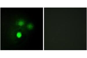 Immunofluorescence analysis of HuvEc cells, using KNTC2 Antibody. (NDC80 Antikörper  (AA 351-400))