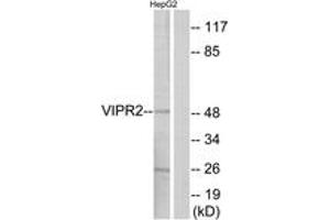 Western blot analysis of extracts from HepG2 cells, using VIPR2 Antibody. (VIPR2 Antikörper)