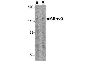 Image no. 1 for anti-SLIT and NTRK-Like Family, Member 3 (SLITRK3) (C-Term) antibody (ABIN1493361) (SLITRK3 Antikörper  (C-Term))