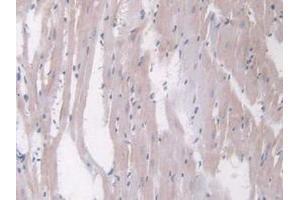IHC-P analysis of Rat Heart Tissue, with DAB staining.