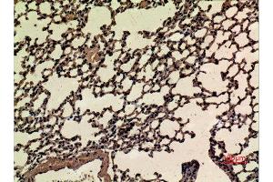 Immunohistochemistry (IHC) image for anti-Nuclear Factor (erythroid-Derived 2)-Like 2 (NFE2L2) (acLys599) antibody (ABIN3188008)
