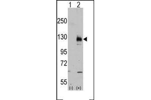 Image no. 2 for anti-Transient Receptor Potential Cation Channel, Subfamily M, Member 8 (TRPM8) (C-Term) antibody (ABIN360717) (TRPM8 Antikörper  (C-Term))
