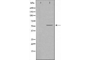 Western blot analysis of extracts from HepG2 cells, using BAIAP2L1 antibody. (BAIAP2L1 Antikörper  (Internal Region))