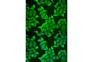 Immunofluorescence analysis of U2OS cells using NGB antibody (ABIN5973872). (Neuroglobin Antikörper)