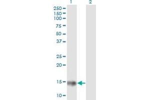 Western Blotting (WB) image for anti-Acid Phosphatase 1, Soluble (ACP1) (AA 1-158) antibody (ABIN513076)