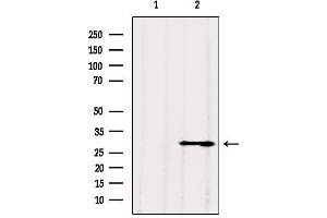 Western blot analysis of extracts from 3t3, using VDAC3 Antibody. (VDAC3 Antikörper  (N-Term))