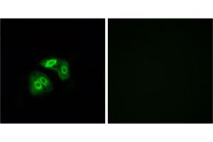 Immunofluorescence analysis of A549 cells, using VN1R5 antibody. (VN1R5 Antikörper)